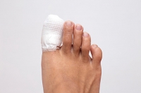 Broken Toes and Scooters