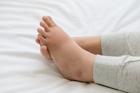 Are Swollen Ankles Normal During Pregnancy?